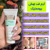 رفع لک و اکنه و جوش و شفاف کننده پوست و یکنواخت کننده پوست با دو محصول ژل انتی اکنه گاتیو و ژل شست و شو ویتابلا
