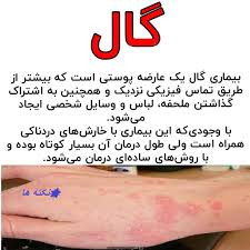 کرم ویتامین e و الوعه ورا برند ویتابلا خارجی درمان بیماری گال دوره دوماهه دوعدد کرم ترمیم کننده و محافظ پوست