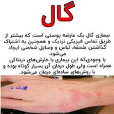 کرم ویتامین e و الوعه ورا برند ویتابلا خارجی درمان بیماری گال دوره دوماهه دوعدد کرم ترمیم کننده و محافظ پوست