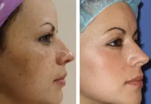 کرم شب برند لاکچری کوین فرانسه 30 میل برای روشن سازی  و جوانسازی و ابرسانی پوست و جوان کننده و یکنواخت کننده  پوست مستقیم از نمایندگی ایران زمین